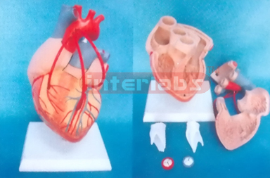 MIDDLE DISEASE HEART MODEL WITH BYPASS